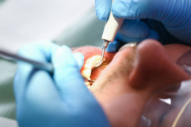 Best Emergency Dentist for Lost Fillings or Crowns in Kalaheo, HI